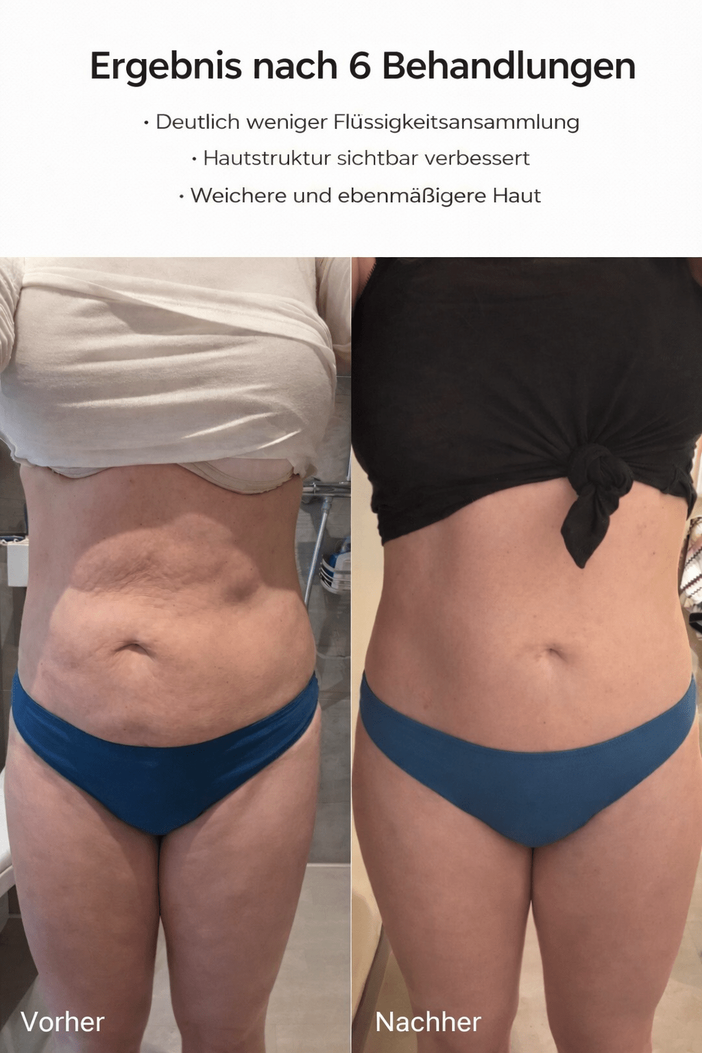 Homiva Sculpt & Firm