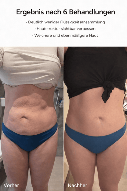 Homiva Sculpt & Firm